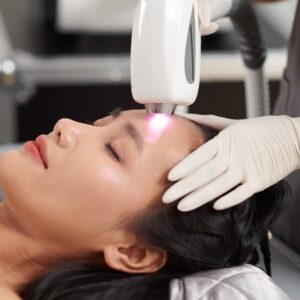 Rejuvenecimiento facial con láser IPL 1 Sesión