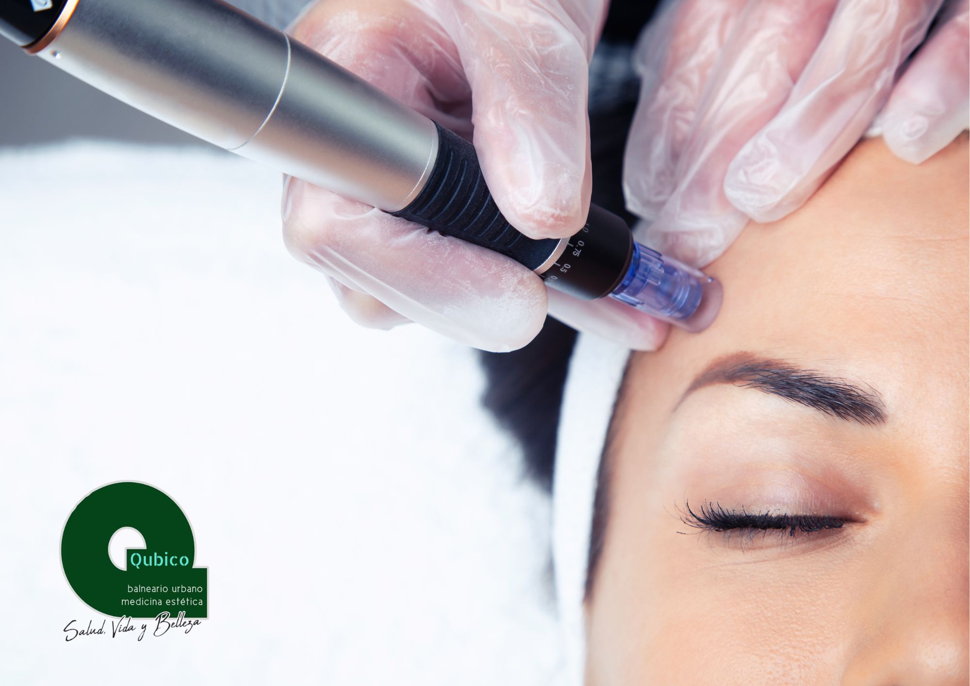 Dermapen o Microneedling - Imagen 4